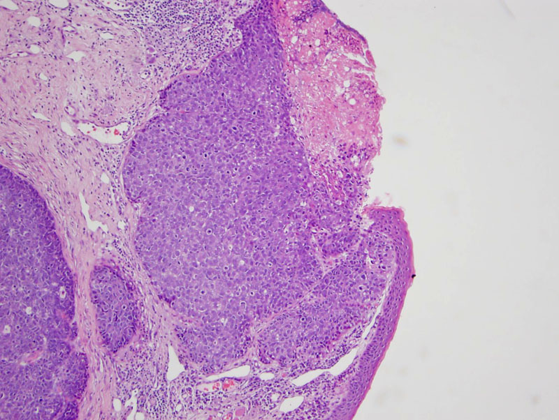 Pathology Image